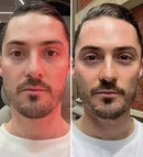 Massageador Lifting Facial