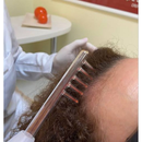 Pente capilar de vidro 5 dentes eletrodo de alta de alta frequência