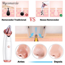 Removedor Cravos e Espinhas Extrator de Cravos Sucção a Vácuo Aparelho Recarregável Sugador Remove Acne